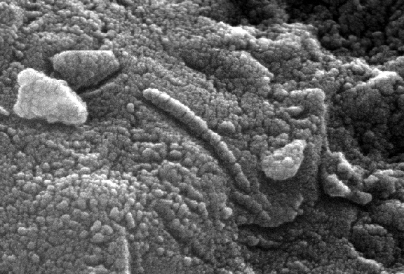 alh840001_micrograph_small.gif